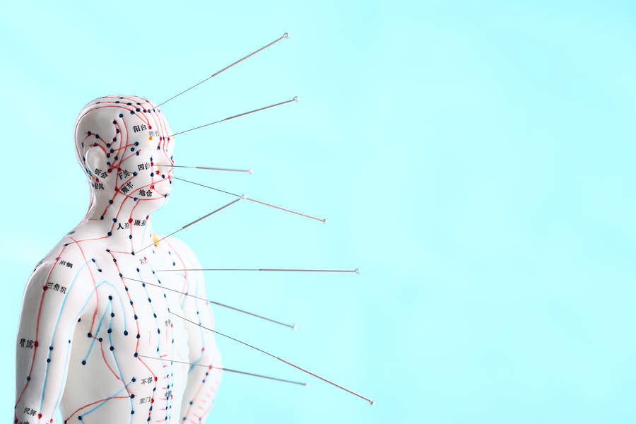 japanese acupuncture from your chiropractor in berkeley heights, NJ
